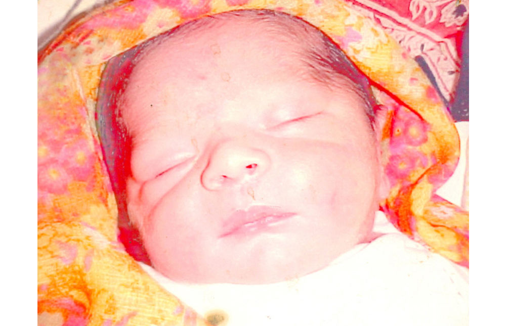 drJatinShah_Babies_51.jpg